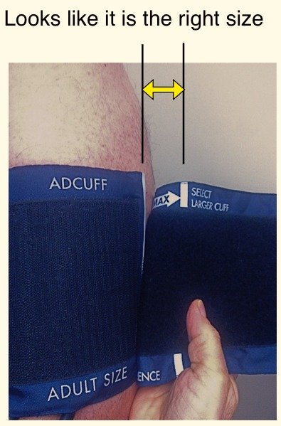 Right Blood Pressure Circumference Picture 