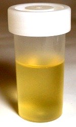 “Urine-sample”align="right"